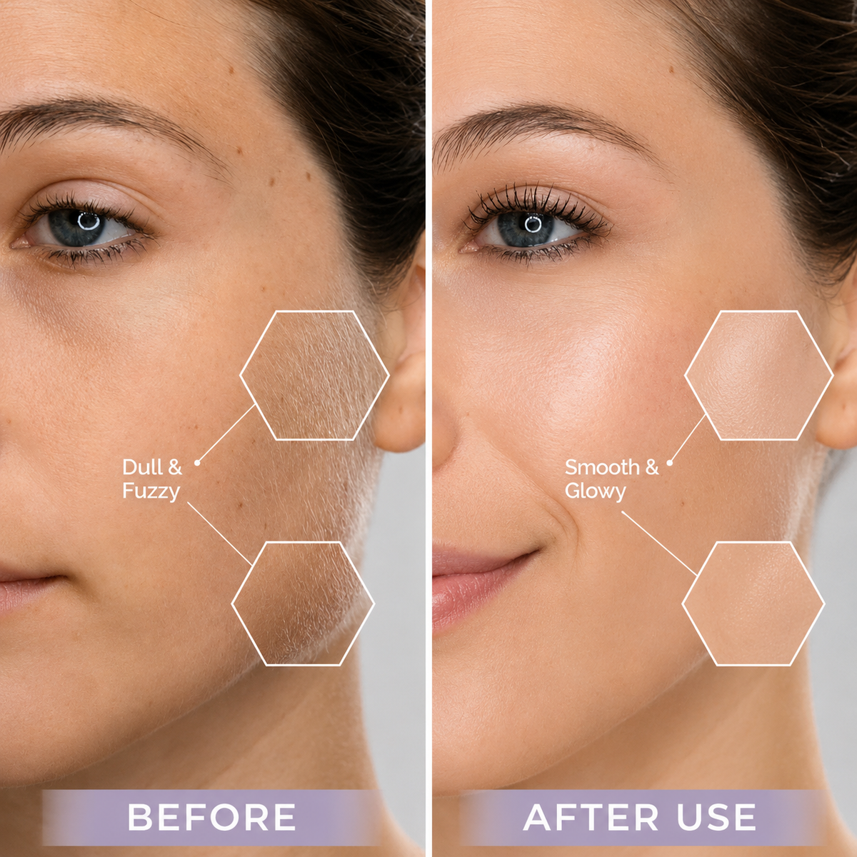 SonicPlane™ Pro | Electric Dermaplaning & Peach Fuzz Remover